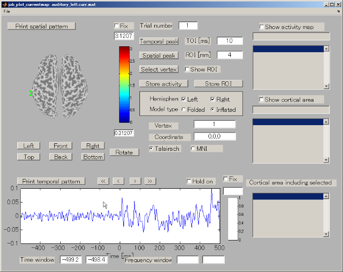 Cortical current viewer