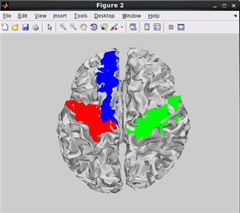 how to plot cortical map on cortical model