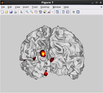 how to plot current on cortical model