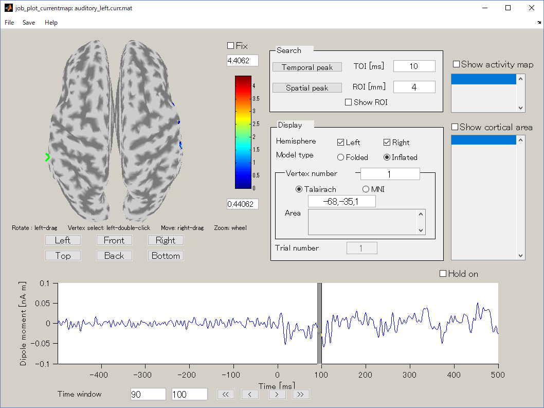 Cortical current viewer