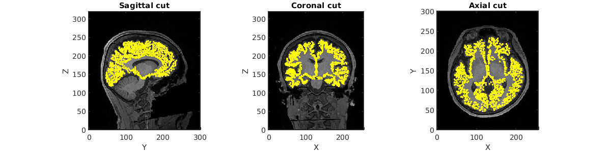 brain