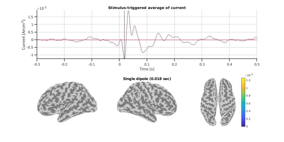 EEG_dipole